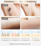 Laser Hair Removal Device IPL Hair Removal Permanent for Women at-Home, Painless Laser Hair Remover Whole Body Armpits Back Legs Arms Face Bikini Line