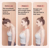 Smart Posture Corrector Miicro Vibration Posture Training Reminder Sensor Back Posture Neck Hump Corrector for Adult Kids