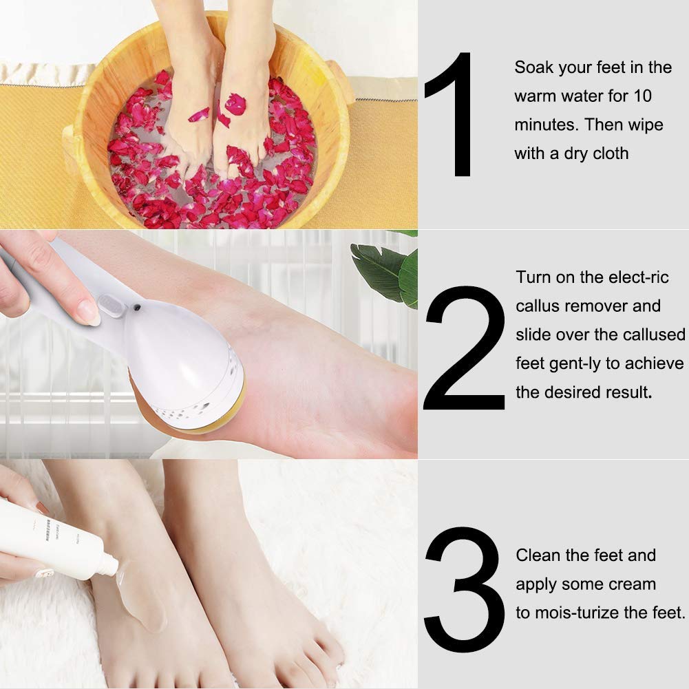 Electric Foot File Callus Remover