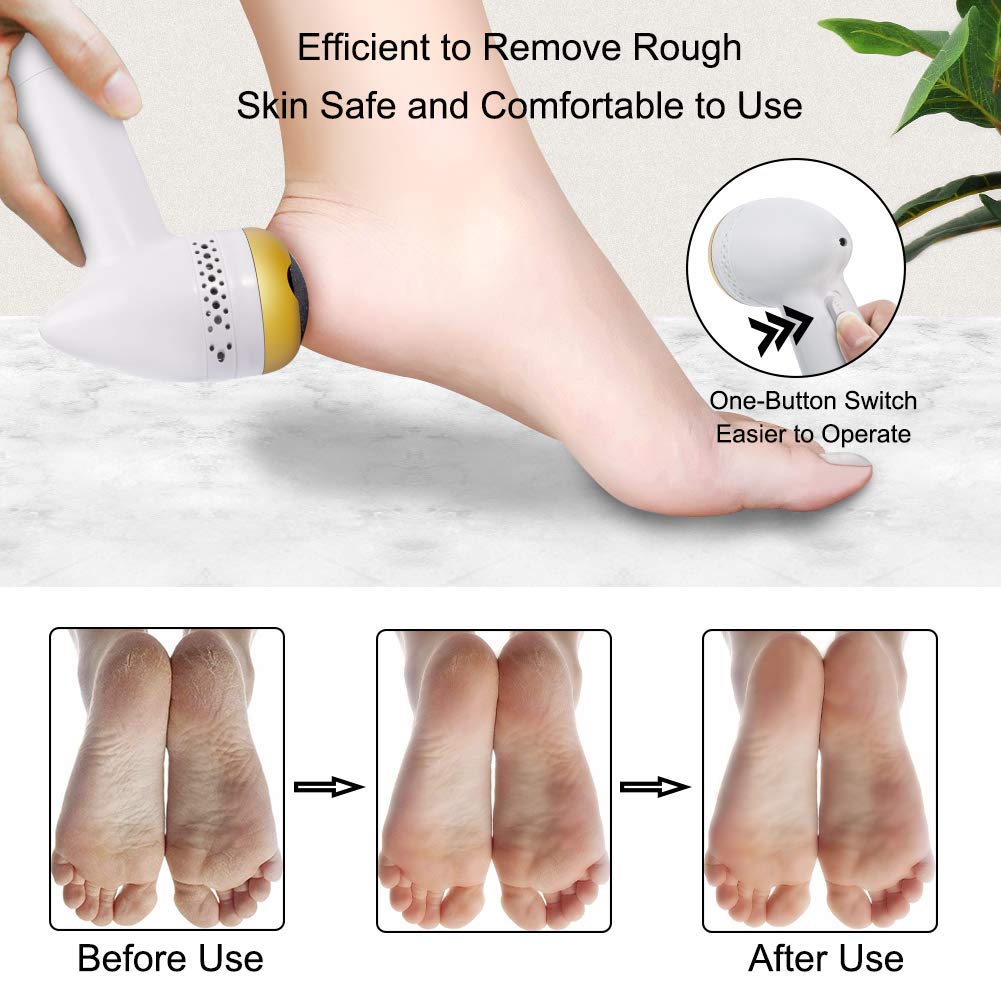 Electric Foot File Callus Remover
