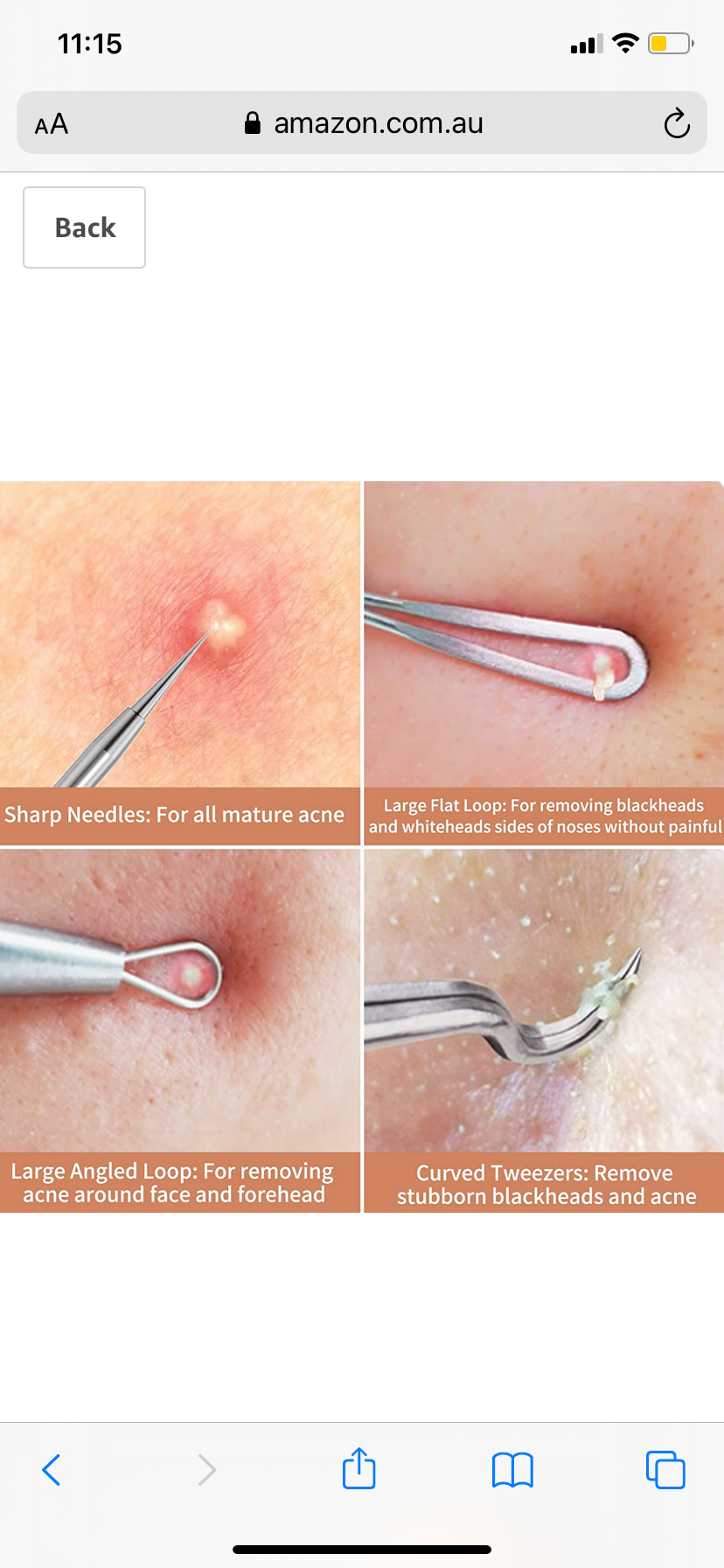 Blackhead Remover Kit