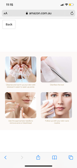 Blackhead Remover Kit