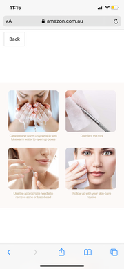 Blackhead Remover Kit